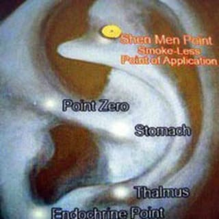 Shen Men Magnetic Acupressure 'Stop Smoking Kit'