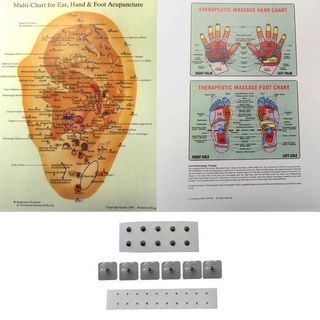 Deluxe 5-piece Acupressure Kit