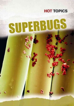 Superbugs (Paperback)