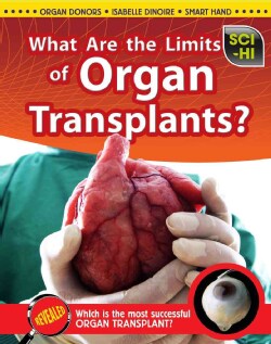 What Are the Limits of Organ Transplants? (Hardcover)
