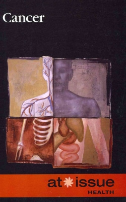 Cancer (Paperback)