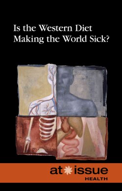 Is the Western Diet Making the World Sick? (Hardcover)