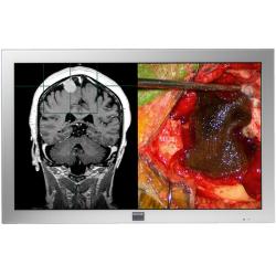 Barco MD-4221 42-inch High Definition LCD Medical Display