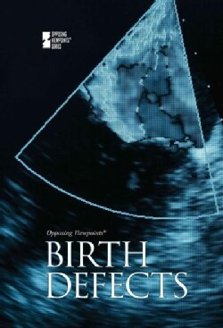 Birth Defects (Hardcover)