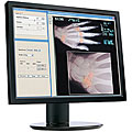 LG L200ME-BF 20-inch LCD Flat Panel Monitor (Refurbished)