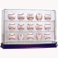 Steiner Sports Glass 15-ball Baseball Case