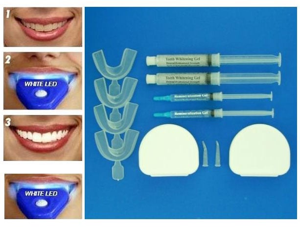 22 or 35-percent Professional Teeth Whitening Kits - 11159958    