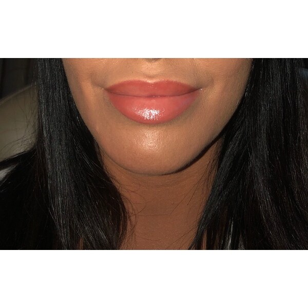 image lip enhancement complex
