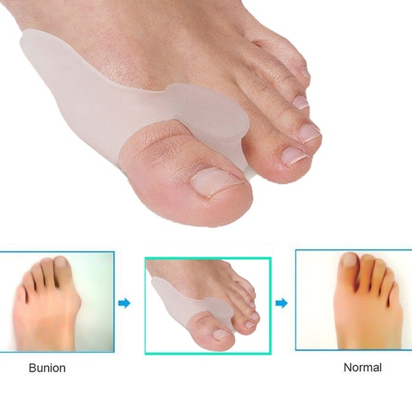 2PCS Gel Bunion Big Toe Straightener Protector Separator Corrector Splint Pad