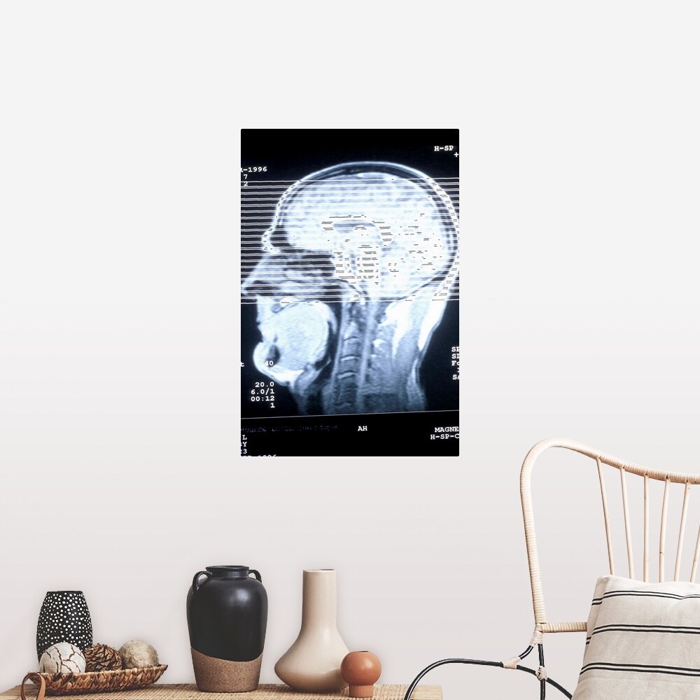 Shop Cat Scan Of Human Head Poster Print Overstock 16471922