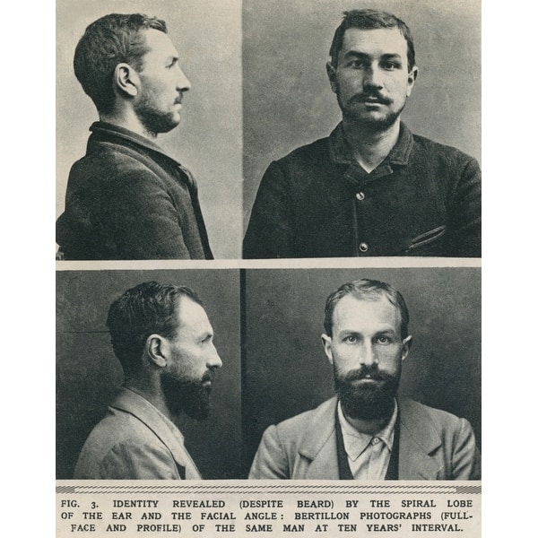 Bertillon System.drawing Bertillon System Photographs Taken At A Ten YearS Interval History ...