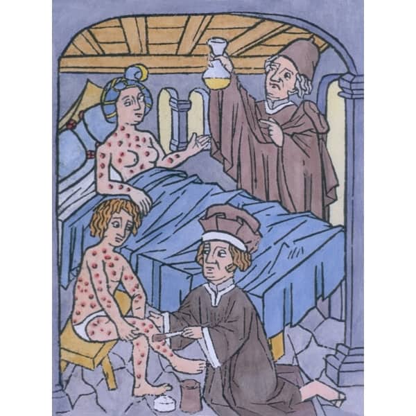 Syphilis Stool Syphilis In Europe A Woman In Bed And A Man Sitting On A Stool Are ...