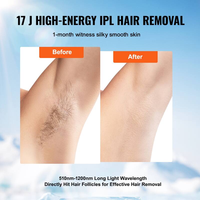 IPL Hair Removal for Legs, Armpits, Bikini Line, Whole Body