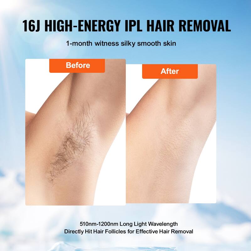 IPL Hair Removal for Legs, Armpits, Bikini Line, Whole Body