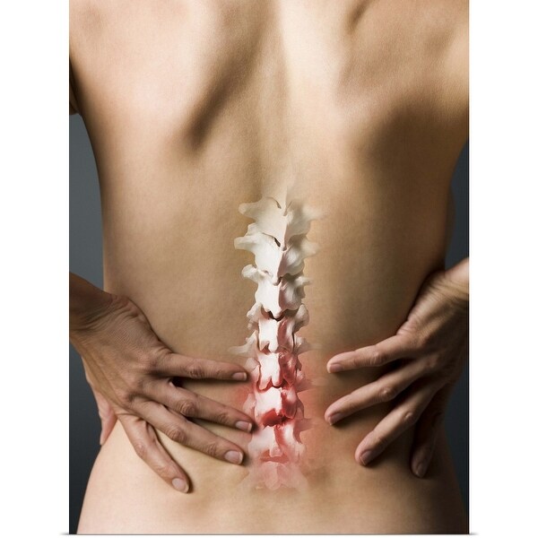 "Rear view of woman with hands on back and sore spine" Poster Print