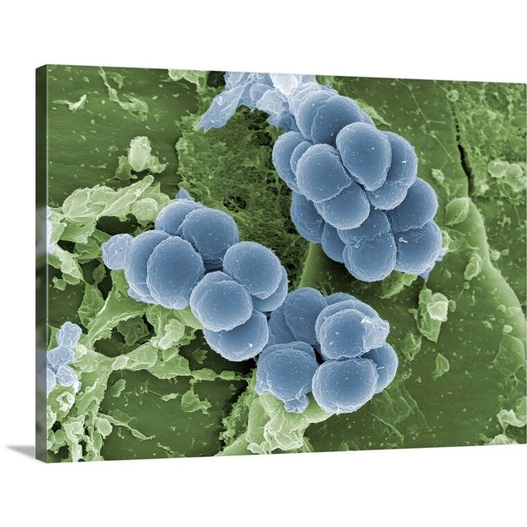 "SEM Micrograph of staphylococcus aureus" Canvas Wall Art