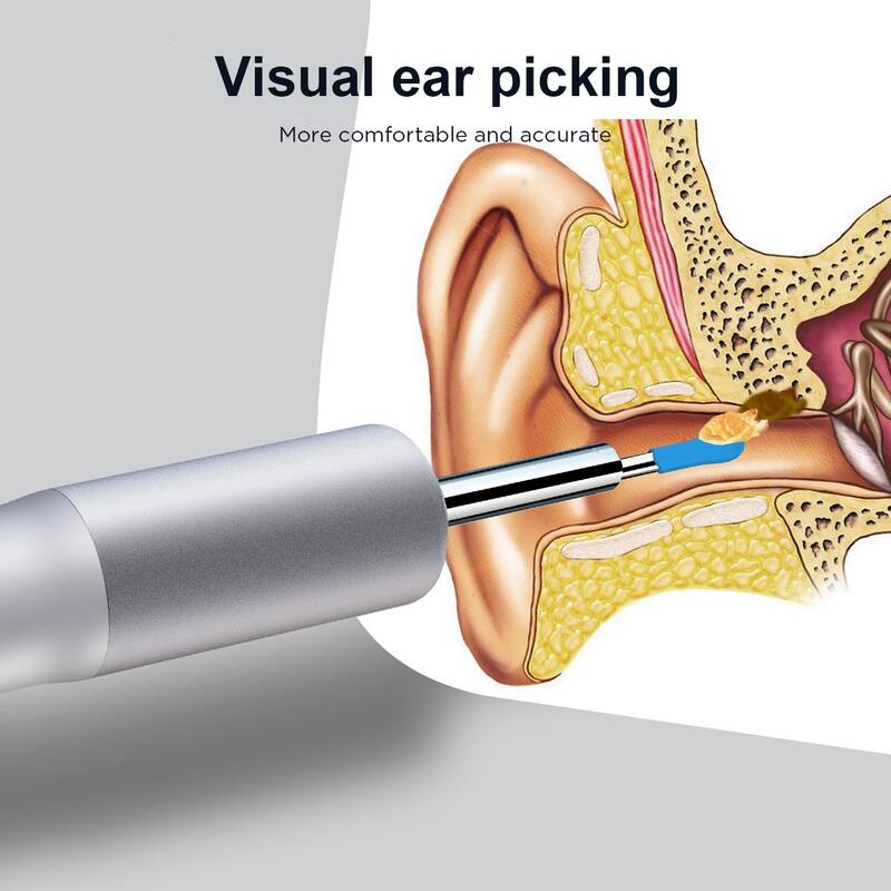 Scalable Ear Endoscope, Endoscope Camera with APP, Wifi connection - Black