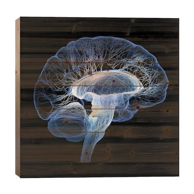 Human Brain Illustrated With Interconnected Small Nerves Print On Wood by Johan Swanepoel - Multi-Color