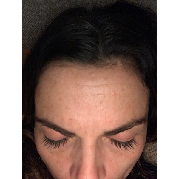 pca peptide smoothing serum